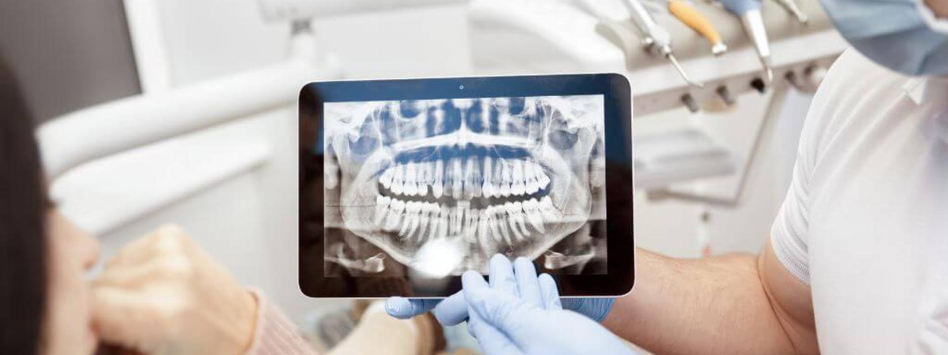 Are Dental X-Rays Safe